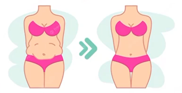 Abdominoplastia - resultado real