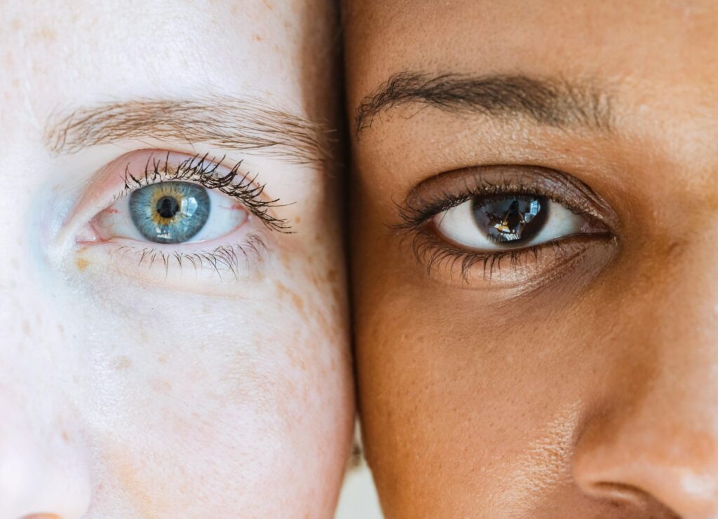 Pálpebra é uma das primeiras áreas a apresentar envelhecimento na face