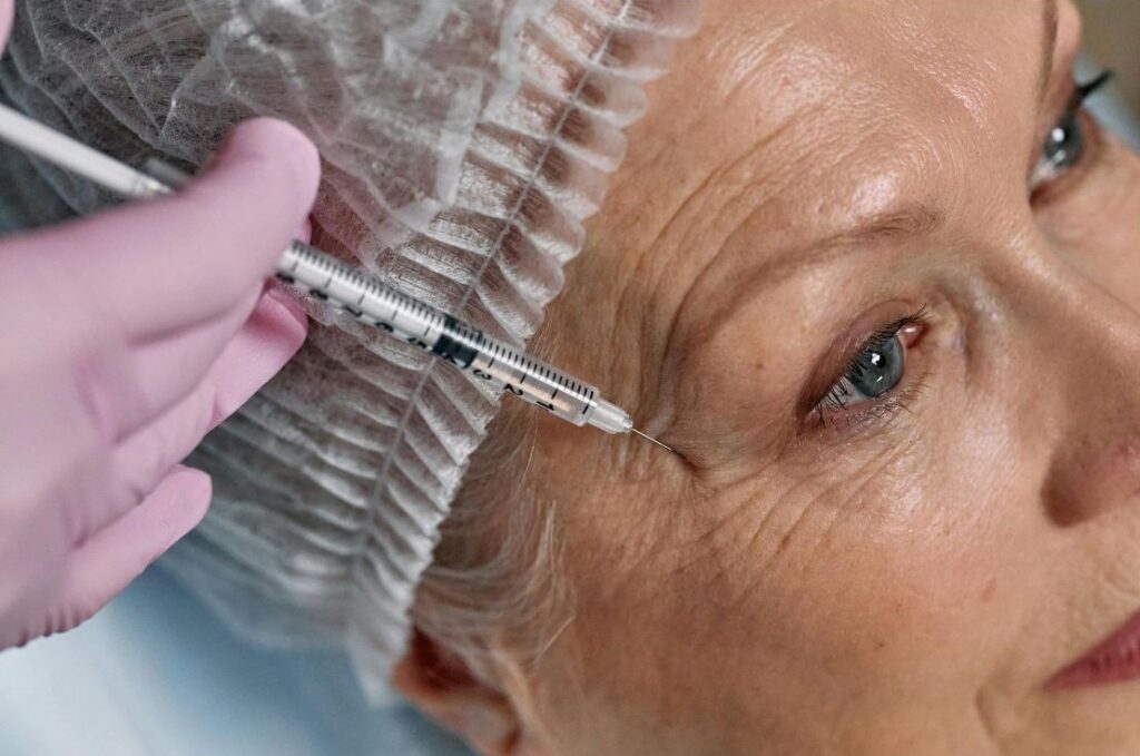 Botox é indicado para amenizar os pés de galinha
